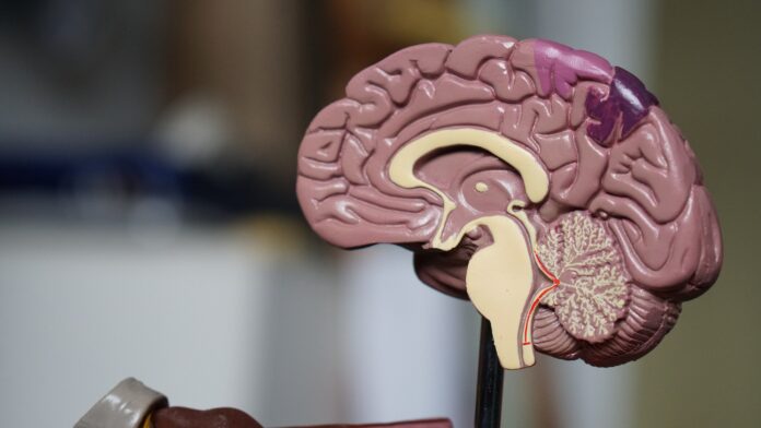 model of a brain