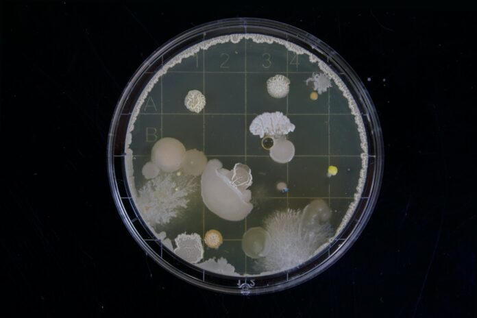 Bacteria on a petri dish