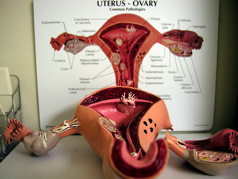 This is a photo of a plastic biology model of a uterus. The model is sitting on a table with medical diagrams behind it.