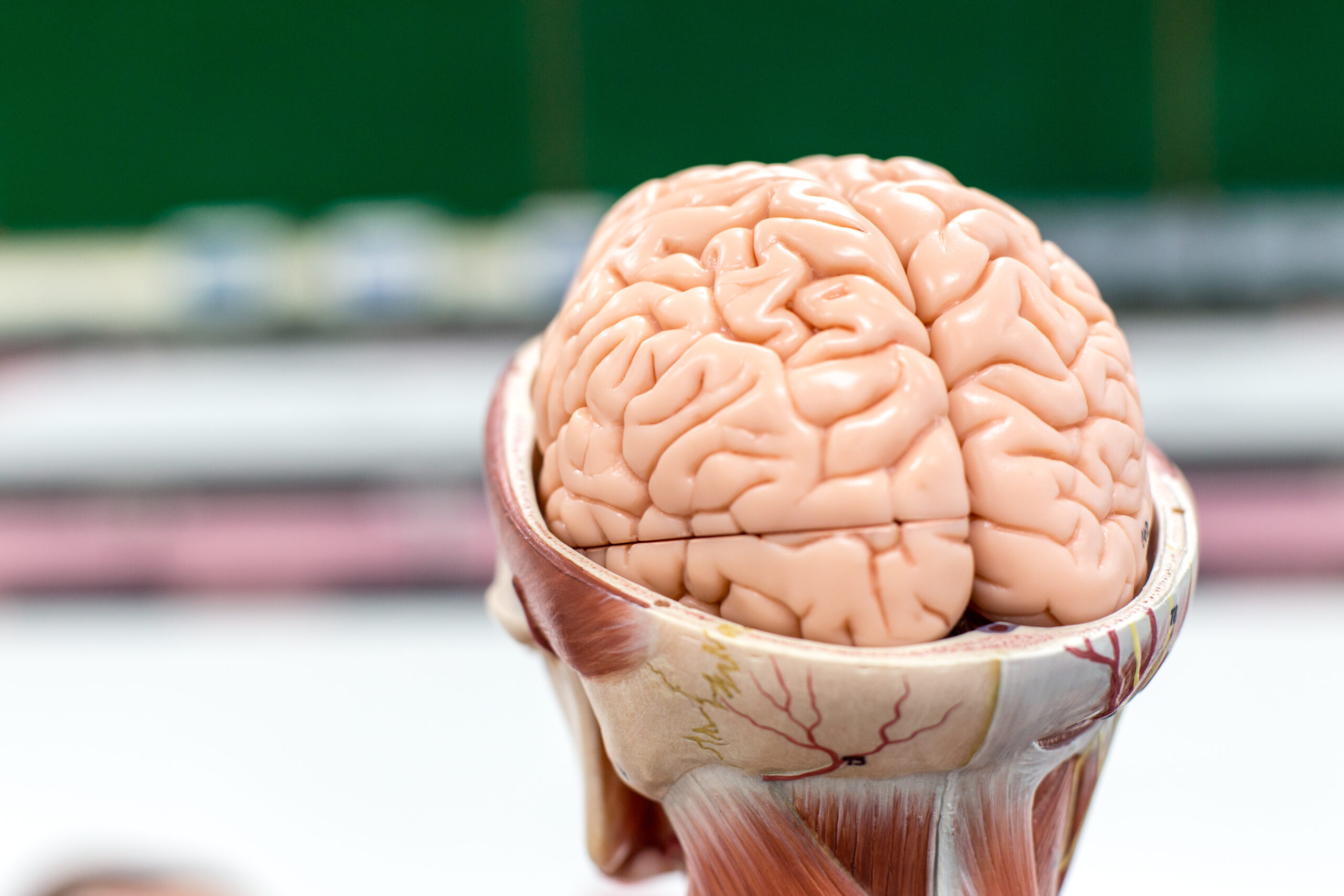 This is a photo of an artificial human brain with a dark green background.