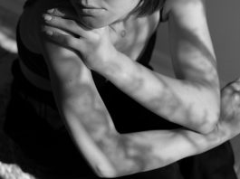 Calls emerge for increased program funding for BC sex workers A woman’s lower body is pictured in black and white while her face is cropped out. The lighting is serious. The woman’s arm is crossed over onto her shoulder, and she looks off to the side.