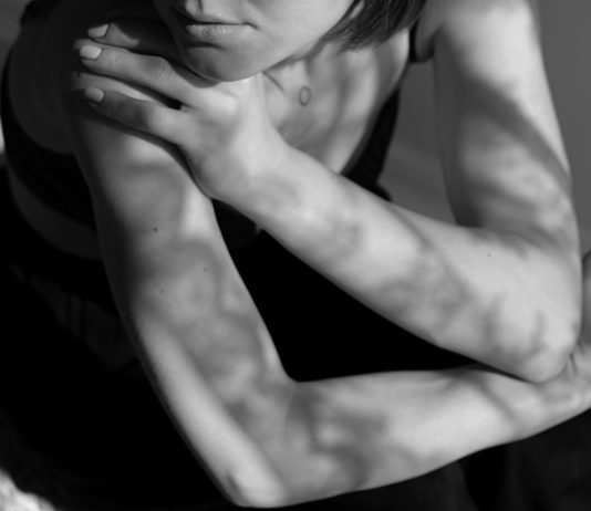 Calls emerge for increased program funding for BC sex workers A woman’s lower body is pictured in black and white while her face is cropped out. The lighting is serious. The woman’s arm is crossed over onto her shoulder, and she looks off to the side.